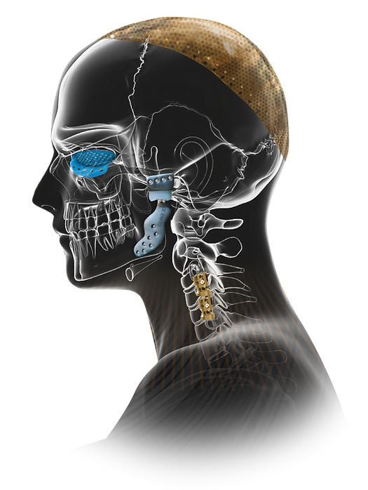 head.png